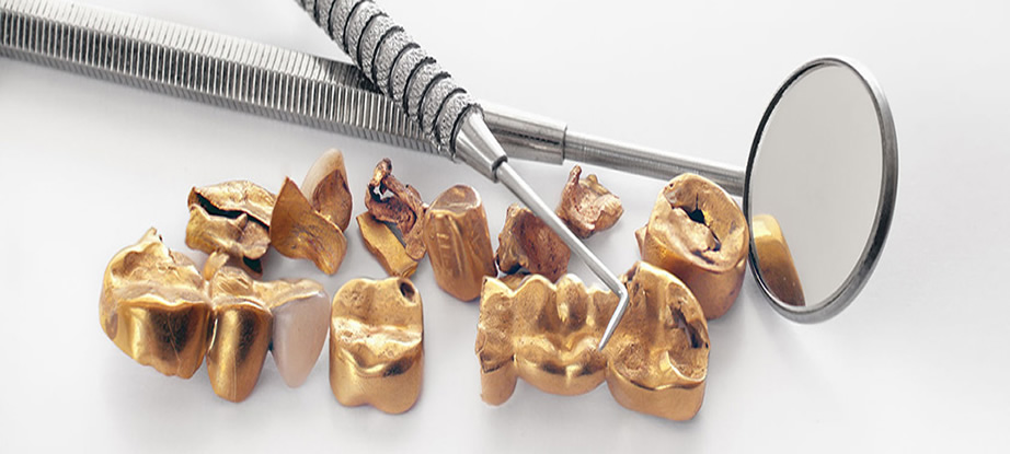 RECUPERO METALLI PREZIOSI DA STUDI DENTISTICI